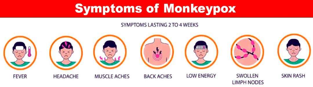 Monkeypox-Symptoms