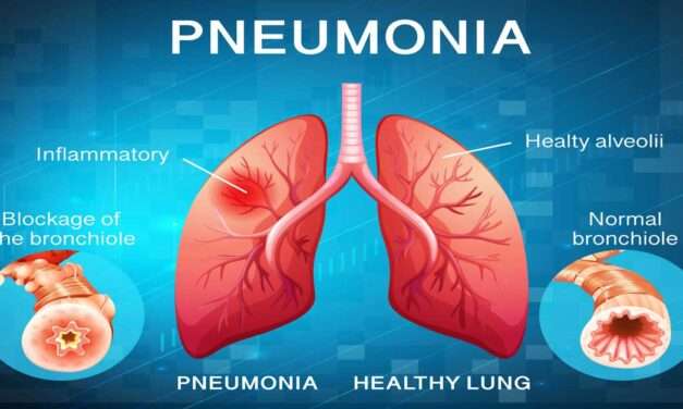 Pneumonia symptoms & Pneumonia causes 2023 | mbbsbooks
