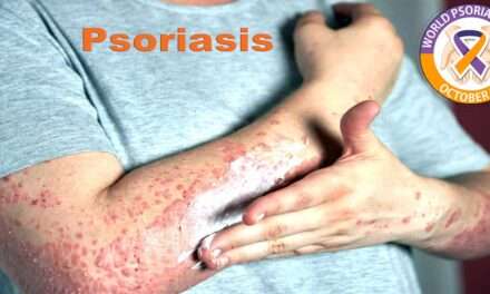 Psoriasis and treatment of Psoriasis 2023 | medical books