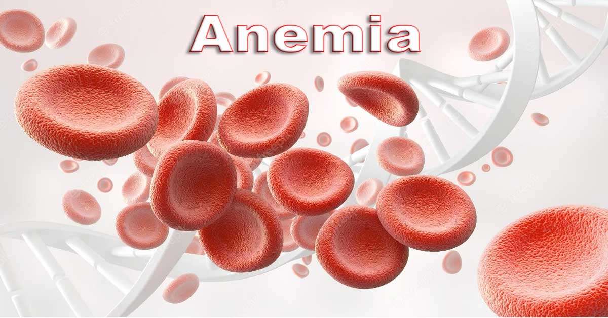 Anemia, causes & anemia treatment 2023 | mbbsbooks